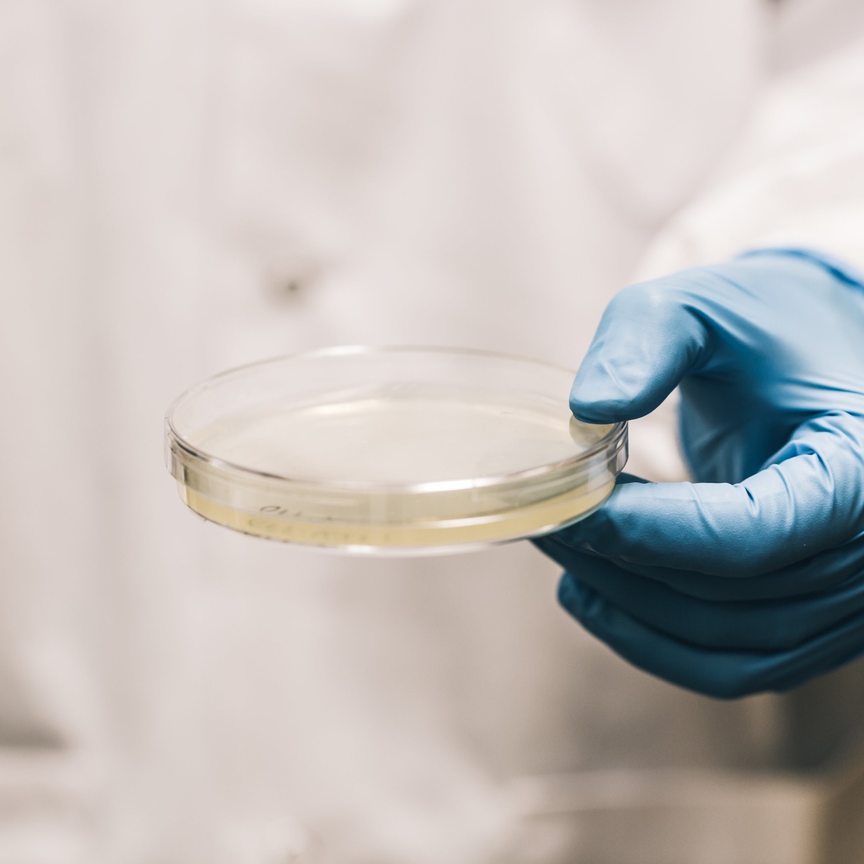 scientist-holding-agar-pietri-dish